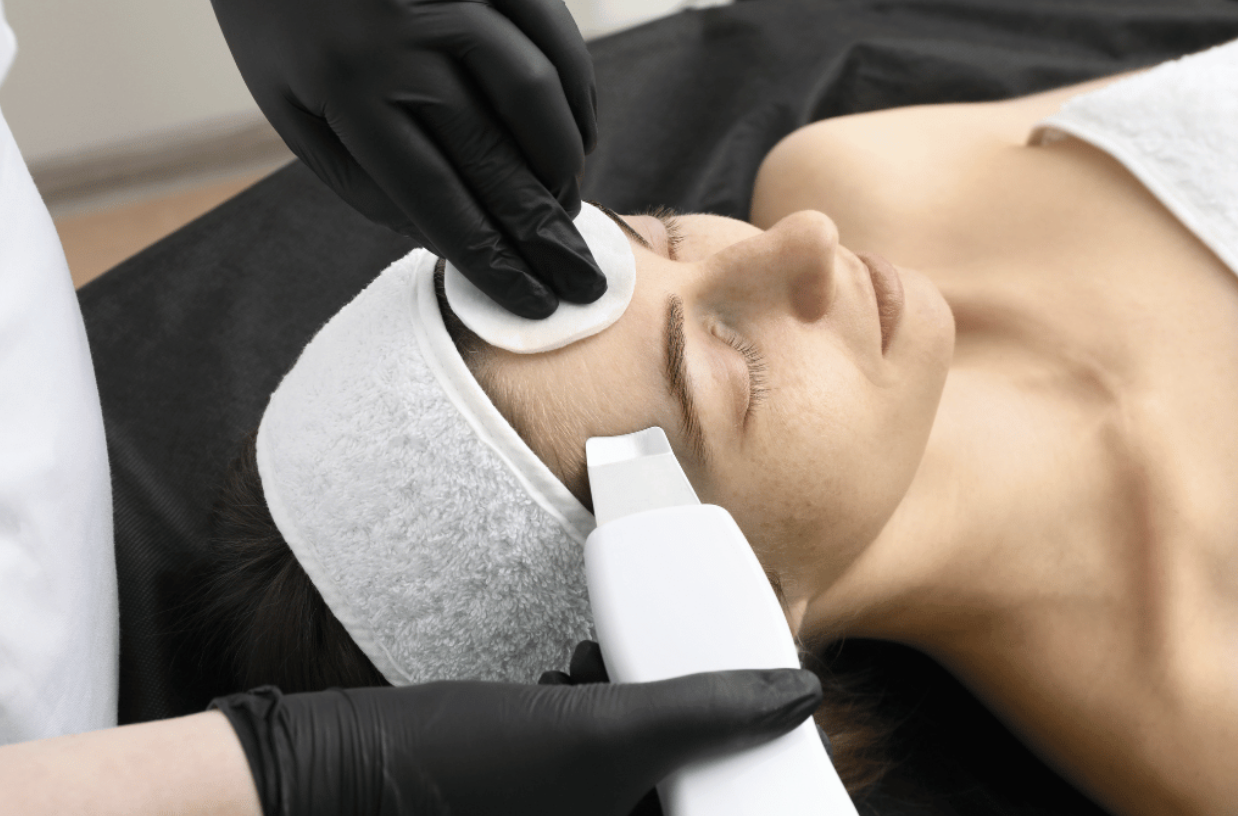 Microdermabrasion treatment
